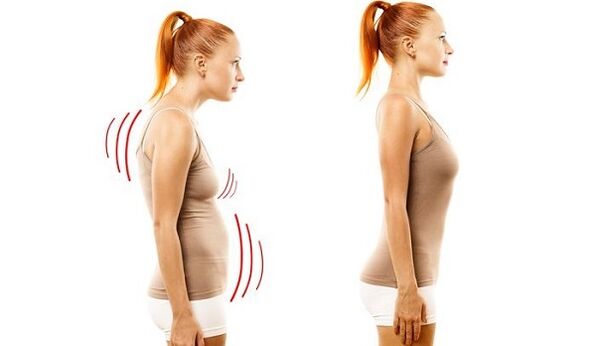 raven hrbet in slaba drža s cervikalno osteohondrozo