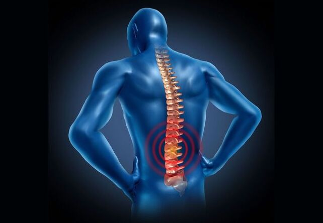 Osteohondroza ledvene hrbtenice je bolezen, ki se pojavi pri večini ljudi