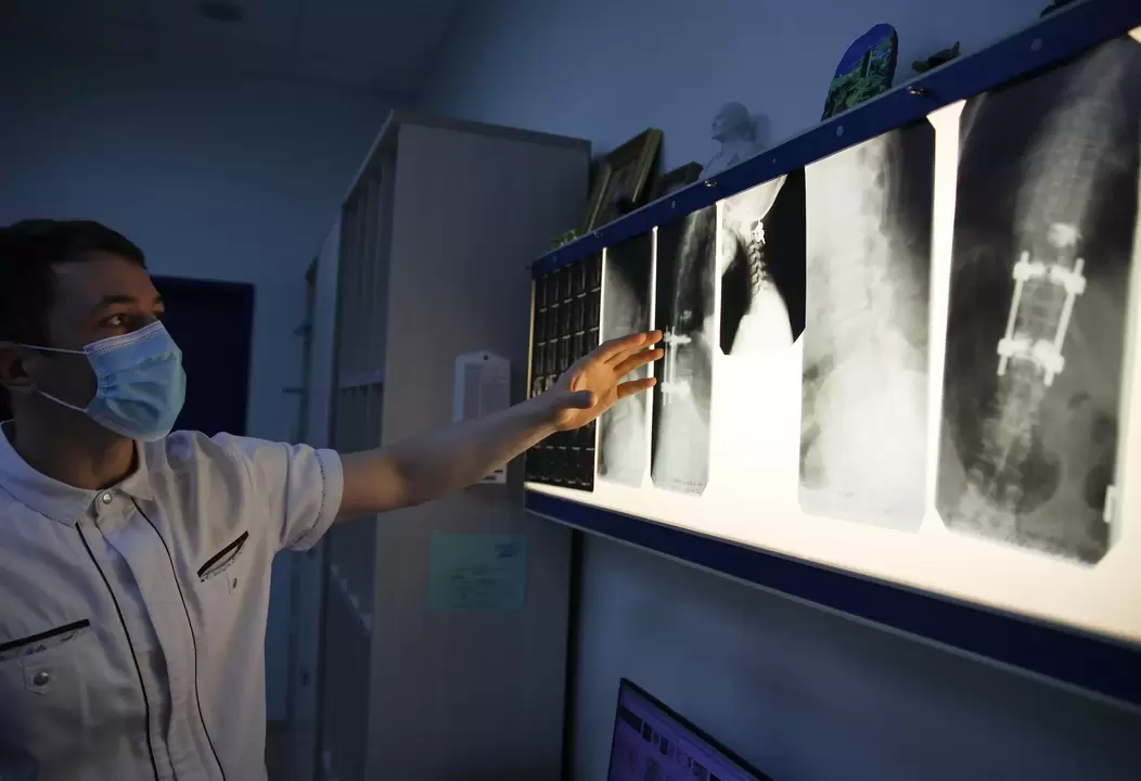 Zdravniki diagnosticirajo cervikalno osteohondrozo z uporabo instrumentalnih metod, kot je radiografija